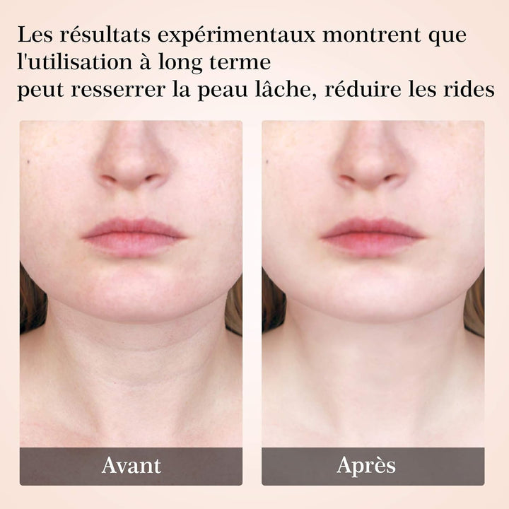 Appareil lifting visage et cou